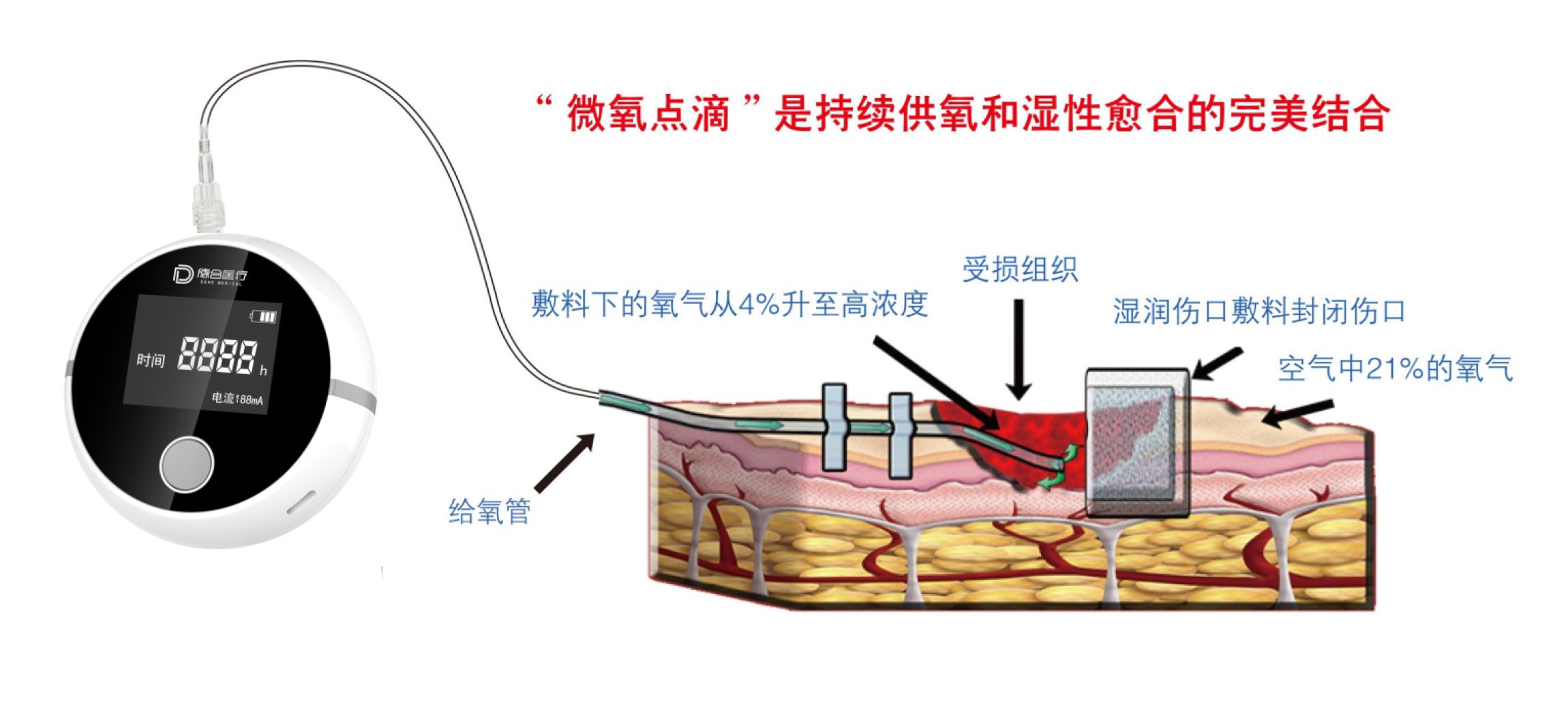 創面氧療儀（二合一）-4_03